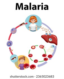 Infografía ilustrada que ilustra las etapas de la transmisión de parásitos de la malaria