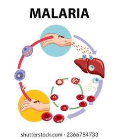 Infografía ilustrada que ilustra las etapas de la transmisión de parásitos de la malaria