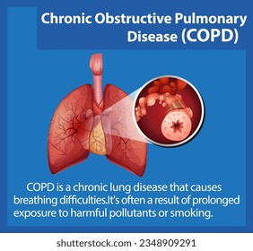 Illustrated infographic explaining chronic obstructive pulmonary disease in human anatomy