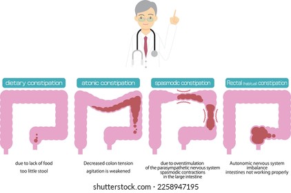 Illustrated types of constipation by cause