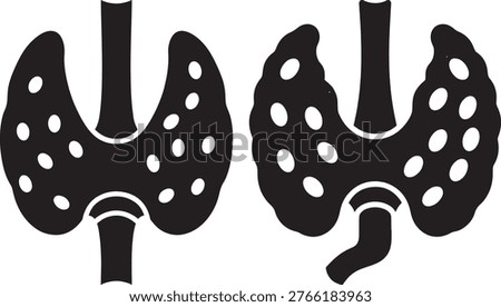 Illustrates two thyroid glands, one appearing normal, other showing abnormality.