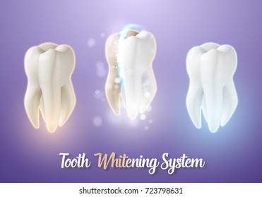 Illustration of 3D Realistic Vector Teeth Cleaning Process. Vector Tooth Cleaning Treatment. Healthcare Stomatology Procedure