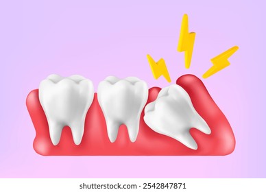 Illustration 3d vector realistic of wisdom tooth under gum cause of pain and lean on other teeth cause of tooth decay. Concept of pain in mouth, toothache, Mesh gradient wes used