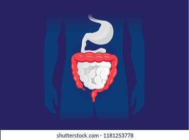 Ilustración sobre los síntomas anormales del intestino Grande humano. Enfermedad del aparato digestivo.