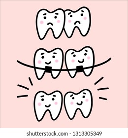 Illustration about dental healthcare with the image of braces on teeth. EPS10. 
Vector image of the stages of orthodontic treatment for posters for dental clinic.