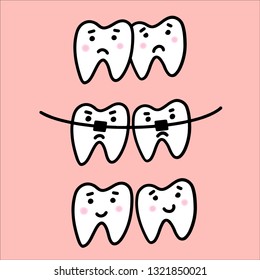 Illustration about dental healthcare with the image of braces on teeth on pink background. EPS10. 
Vector image of the stages of orthodontic treatment for dental clinic poster in flat cartoon style.