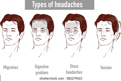 Illustration about headaches 4 type on different area of patient head.