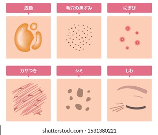 皮膚のいろいろな問題を紹介 この文章は 日本語で 皮脂 黒ずんだ毛穴 にきび 肌の乾燥 しみ しわ を意味します のベクター画像素材 ロイヤリティフリー
