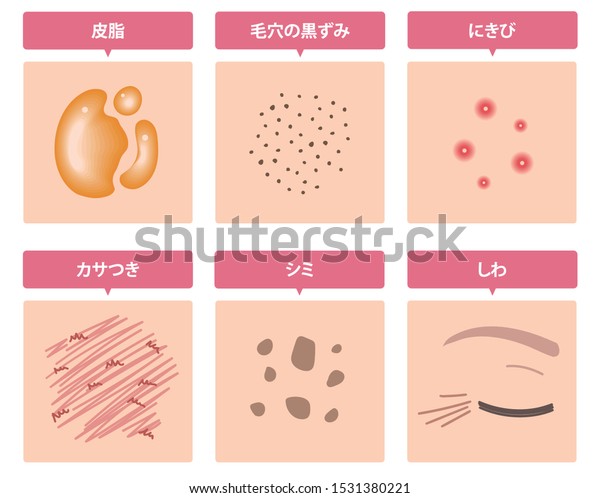 皮膚のいろいろな問題を紹介 この文章は 日本語で 皮脂 黒ずんだ毛穴 にきび 肌の乾燥 しみ しわ を意味します のベクター画像素材 ロイヤリティフリー