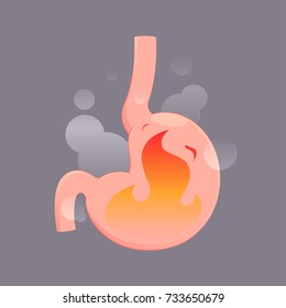 Illustration From Acid Reflux Or Heartburn, Cartoon Vector, Concept With Internal Health