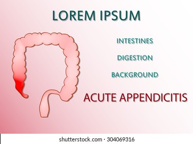 Illustration Acute Appendicitis Intestines Bowel Stock Vector (Royalty ...