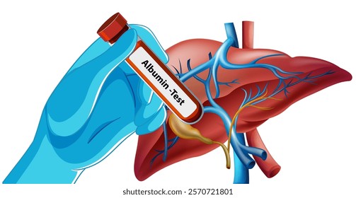 Illustration of albumin test for liver function