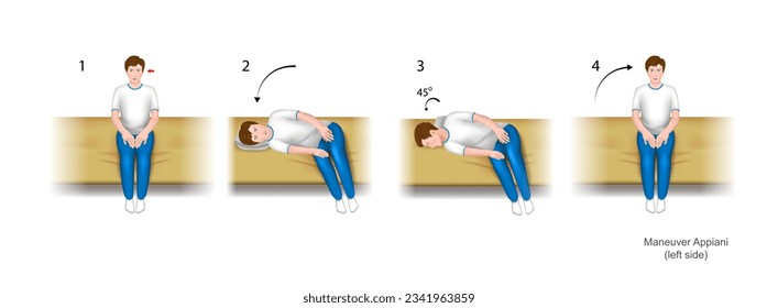 Illustration of the Appiani maneuver, a practical guide to the treatment of benign positional paroxysmal vertigo (bppv). With damage to the left ear. Training manual, education. Vector.