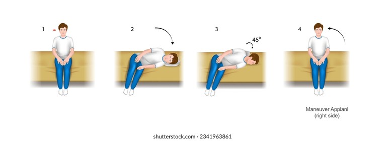 Illustration of the Appiani maneuver, a practical guide to the treatment of benign positional paroxysmal vertigo (bppv). With damage to the right ear. Training manual, education. Vector.