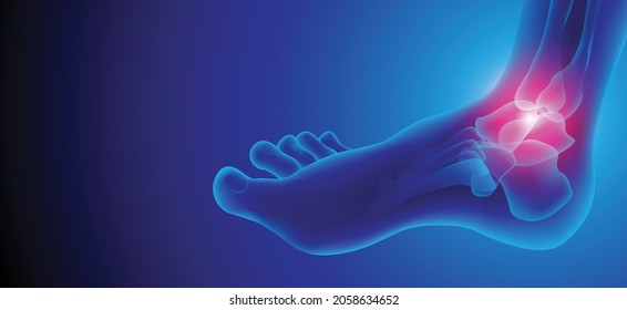 Illustration des Gelenks der Arthritis . rheumatoide Arthritis.  Menschliche Knochenanatomie, flache Vektorgrafik auf blauem Hintergrund. 3d gerenderte medizinisch korrekte Abbildung.