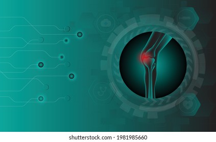 Illustration of Arthritis knee joint . Rheumatoid arthritis. Pain in leg. Human bone anatomy flat vector illustration. Painful injury erosion on a green technology background.