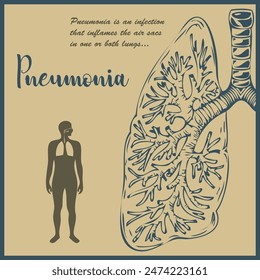 Illustration of awareness of Pneumonia is an infection that inflames the air sacs in one or both lungs.