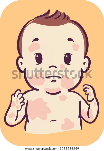 顔と体中に皮膚のある赤ちゃん男の子のイラスト のベクター画像素材