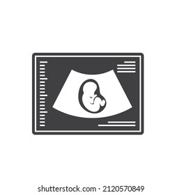 illustration of baby ultrasound scanning, vector art.