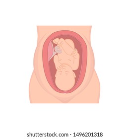 illustration of a baby in the womb. Pregnant with fetus. silhouette of pregnant woman isolated on white background