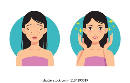 Illustration before and after facial acne treatment from a beautiful girl.