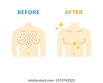 Illustration of before and after icons for chest hair removal.