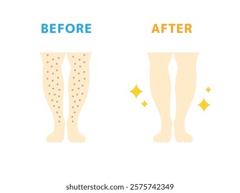 Illustration of before and after icons for leg hair removal.