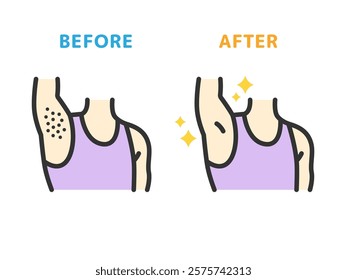 Illustration of before and after icons (line drawing color) for underarm hair removal.