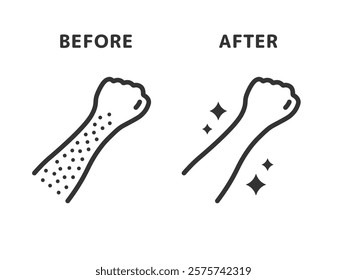 Illustration of before and after icons (line drawings) for arm hair removal.