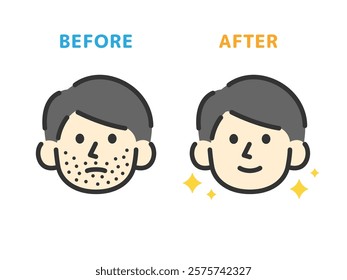 Illustration of before and after icons (line drawing color) for beard hair removal.