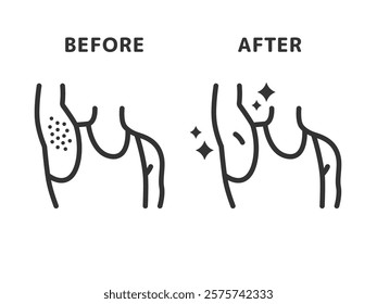 Illustration of before and after icons (line drawings) for underarm hair removal.