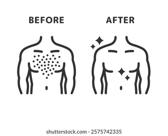 Illustration of before and after icons (line drawings) for chest hair removal.