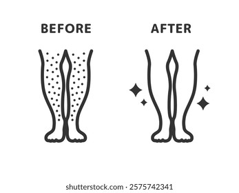 Illustration of before and after icons (line drawings) for leg hair removal.