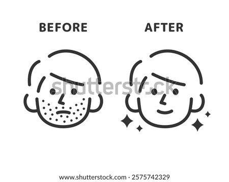 Illustration of before and after icons (line drawings) for beard hair removal.