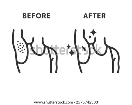 Illustration of before and after icons (line drawings) for underarm hair removal.