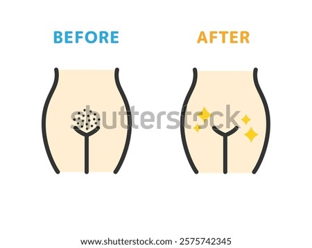 Illustration of before and after icons (line drawing color) for V-line hair removal.