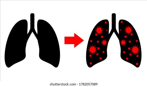 illustration before and after the lungs are infected by covid-19