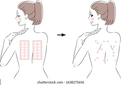 
Illustration before and after a woman is taking a patch test