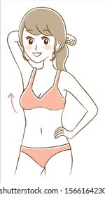 Illustration of breast augmentation surgery