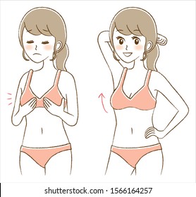 Illustration of breast augmentation surgery