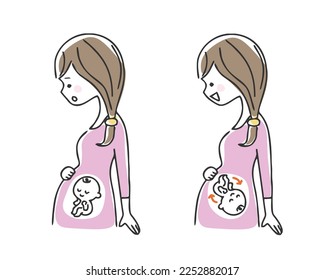 Illustration of a breech baby and a normal baby.