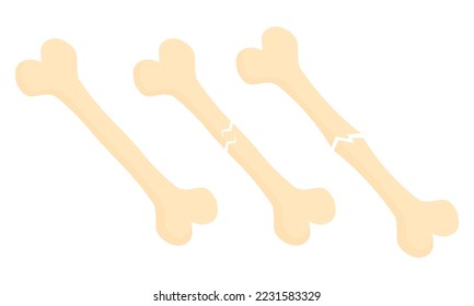 illustration of broken bones and normal bones on a medical theme on a white background