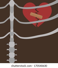illustration of a broken heart within the chest