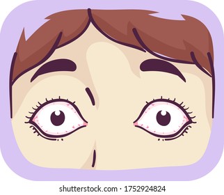 Illustration Of Bulging Eyes Of A Girl, Symptom Of Graves Disease