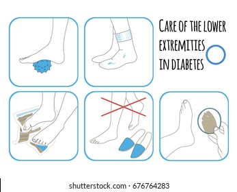 Illustration Care Of Feet In Diabetes