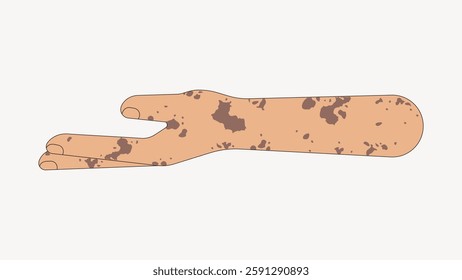 Illustration of a cartoon arm with brown spots, resembling a thumbs-up gesture. The arm is stylized with spots, emphasizing a playful, artistic design. Vector illustration.