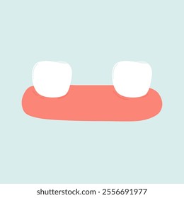 Illustration of a Case of Tooth Loss