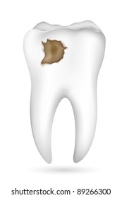 illustration of cavity in tooth on white background