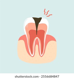 Illustration of Cavity Toothache Problems