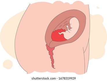 Illustration of a child growing in mother's belly.